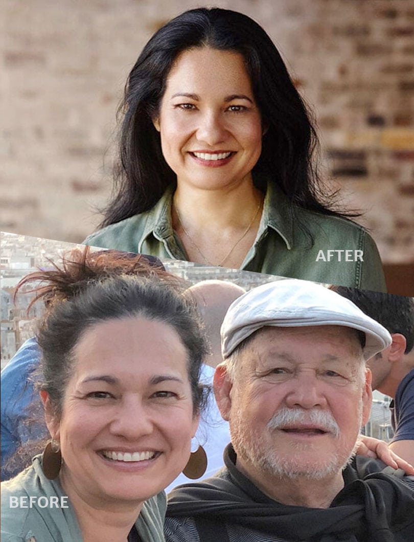 before-after - Skinny60